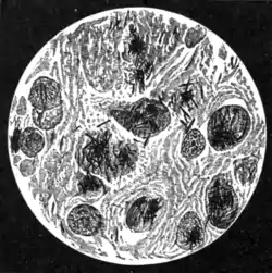 Tropical Diseases - Fig 88.png