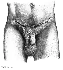 Tropical Diseases - Fig 94.png