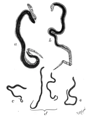 Tropical Diseases - Fig 96.png