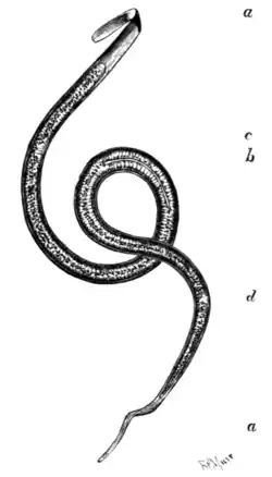 Tropical Diseases - Fig 97.png