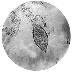 Tropical Diseases - Plate 13 Fig 1.png