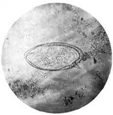 Tropical Diseases - Plate 13 Fig 2.png