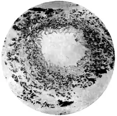 Tropical Diseases - Plate 14 Fig 2.png