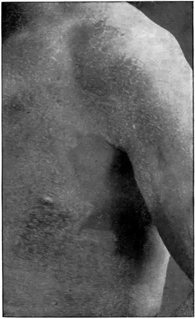 Tropical Diseases - Plate 15.png