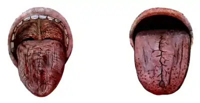 Tropical Diseases - Plate 9.png