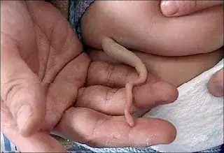 human tail