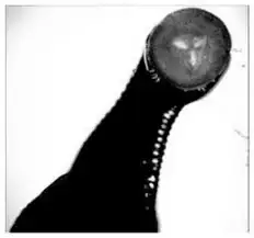 A gross black-and-white image of a leeche's mouth